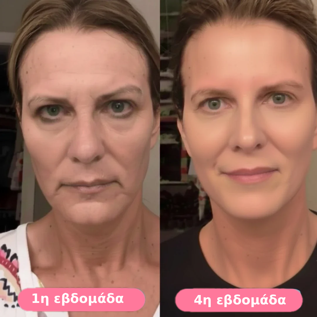 Serum collagen