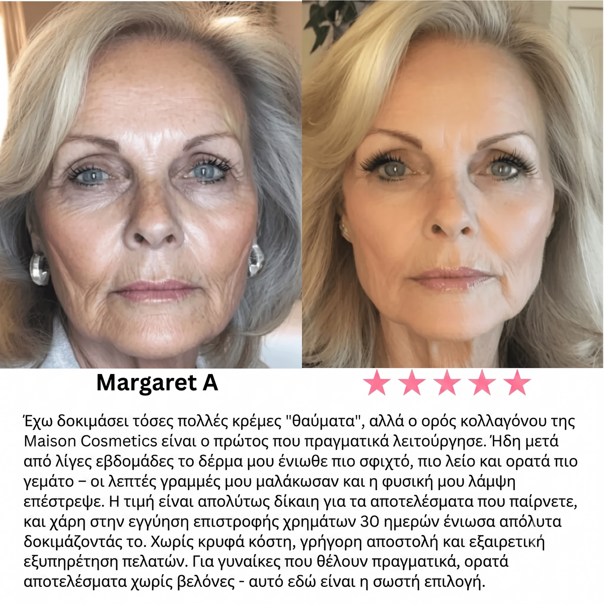 Serum collagen
